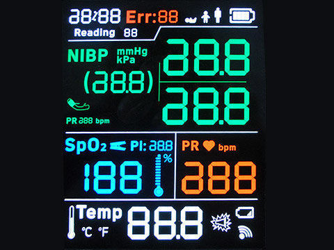 STN YG ST7565R 7 Segmentlcd het Scherm het Zwart-wit 128X64 Punten FPC Solderen